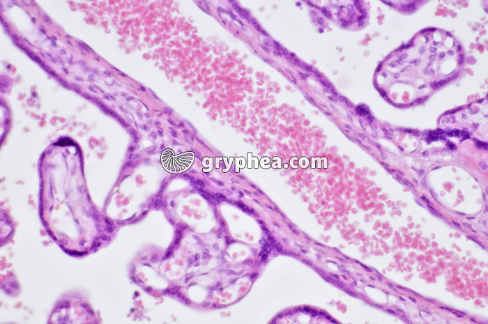 Placenta humain x100 - gryphea.org